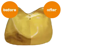 バックのエステ